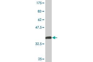Western Blot detection against Immunogen (37.