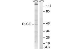 Western blot analysis of extracts from LOVO cells, using AGPAT5 Antibody. (AGPAT5 anticorps  (AA 241-290))