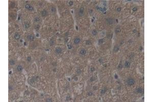 Detection of ALOX12 in Human Liver Tissue using Polyclonal Antibody to Arachidonate-12-Lipoxygenase (ALOX12)