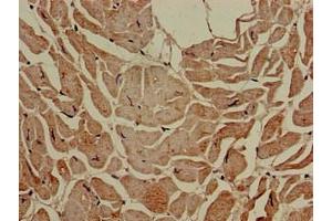 Immunohistochemistry of paraffin-embedded human heart tissue using ABIN7160165 at dilution of 1:100 (SLC16A7 anticorps  (AA 197-279))