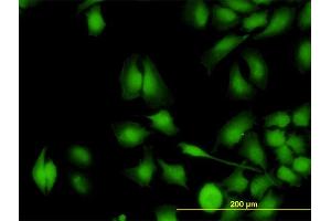 Immunofluorescence of monoclonal antibody to ZNF622 on HeLa cell.