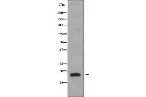 Western blot analysis of extracts from K562 cells, using PBOV1 antibody. (PBOV1 anticorps  (Internal Region))