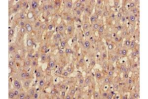 Immunohistochemistry of paraffin-embedded human liver tissue using ABIN7170002 at dilution of 1:100