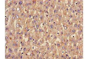 Immunohistochemistry of paraffin-embedded human liver tissue using ABIN7170002 at dilution of 1:100 (GLUT1 anticorps  (AA 263-458))