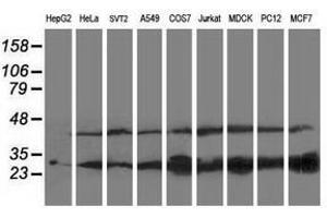 Image no. 2 for anti-Pyridoxamine 5'-Phosphate Oxidase (PNPO) antibody (ABIN1500319)
