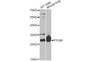 Western blot analysis of extracts of various cell lines, using PTGIR antibody (ABIN5970948) at 1/1000 dilution. (Prostacyclin Receptor anticorps)