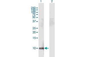 Western Blot analysis of HEPN1 expression in transfected 293T cell line by HEPN1 MaxPab polyclonal antibody. (HEPN1 anticorps  (AA 1-88))