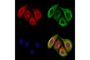 ABIN7094435 and ABIN7098483 staining Hela cells by IF/ICC. (METTL5 anticorps  (Internal Region))