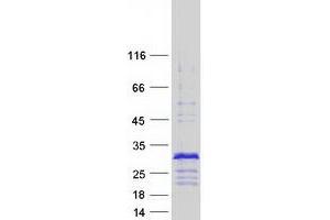 Validation with Western Blot