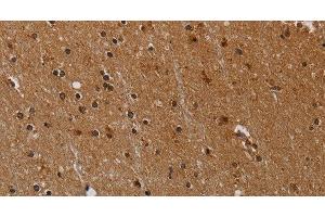 Immunohistochemistry of paraffin-embedded Human brain tissue using PARP8 Polyclonal Antibody at dilution 1:40 (PARP8 anticorps)
