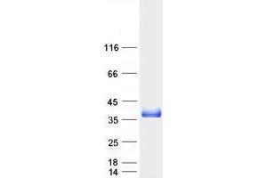 Validation with Western Blot
