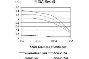 Black line: Control Antigen (100 ng),Purple line: Antigen (10 ng), Blue line: Antigen (50 ng), Red line:Antigen (100 ng)