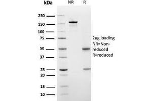 SDS-PAGE Analysis Purified PAI-RBP1 Mouse Monoclonal Antibody (SERBP1/3498). (SERBP1 anticorps  (AA 3-139))