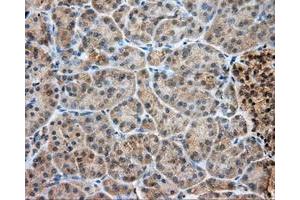 Immunohistochemical staining of paraffin-embedded Kidney tissue using anti-LIPG mouse monoclonal antibody. (LIPG anticorps)