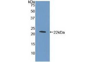 Detection of Recombinant MPL, Human using Polyclonal Antibody to Thrombopoietin Receptor (TPOR) (MPL anticorps  (AA 311-460))