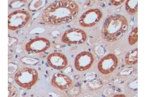 Detection of IDH1 in Human Kidney Tissue using Polyclonal Antibody to Isocitrate Dehydrogenase 1, Soluble (IDH1) (IDH1 anticorps  (AA 74-333))