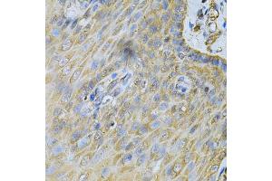 Immunohistochemistry of paraffin-embedded human esophagus using PDGFB Antibody (ABIN1874072) at dilution of 1:100 (40x lens). (PDGFB anticorps)