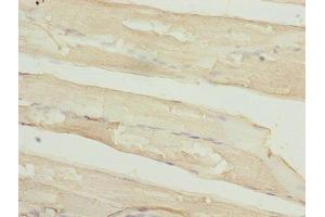 Immunohistochemistry of paraffin-embedded human skeletal muscle tissue using ABIN7159481 at dilution of 1:100 (TIMP1 anticorps  (AA 24-207))