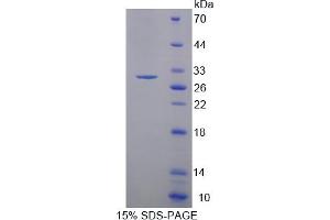 Image no. 1 for Myosin Light Chain Kinase 3 (MYLK3) (AA 555-786) protein (His tag) (ABIN4989829)