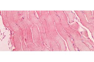 Detection of MYO in Human Skeletal Muscle Tissue using Polyclonal Antibody to Myoglobin (MYO)