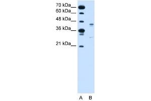 GPR161 antibody used at 2 ug/ml to detect target protein. (GPR161 anticorps  (Middle Region))