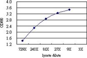 CD5L (Human) Matched Antibody Pair