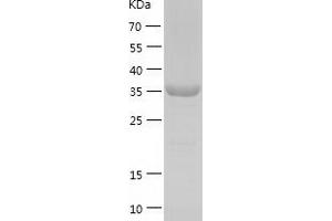 Western Blotting (WB) image for ISL LIM Homeobox 1 (ISL1) (AA 2-349) protein (His-IF2DI Tag) (ABIN7123637)