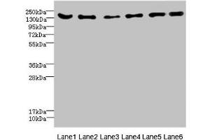 Western blot All lanes: CD1C antibody at 4. (ADGRG6 (AA 40-300) anticorps)