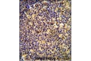 ANR44 Antibody (Center) (ABIN654733 and ABIN2844421) immunohistochemistry analysis in formalin fixed and paraffin embedded human tonsil tissue followed by peroxidase conjugation of the secondary antibody and DAB staining. (ANKRD44 anticorps  (AA 481-510))