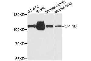 Western blot analysis of extracts of various cell lines, using CPT1B antibody. (CPT1B anticorps  (AA 533-772))