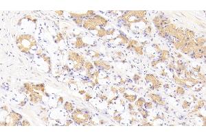 Detection of FASL in Human Stomach Tissue using Polyclonal Antibody to Factor Related Apoptosis Ligand (FASL)