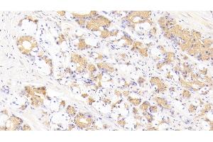 Detection of FASL in Human Stomach Tissue using Polyclonal Antibody to Factor Related Apoptosis Ligand (FASL) (FASL anticorps  (AA 103-281))