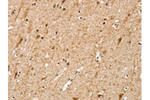 The image on the left is immunohistochemistry of paraffin-embedded Human brain tissue using ABIN7192648(SRP68 Antibody) at dilution 1/25, on the right is treated with synthetic peptide. (SRP68 anticorps)