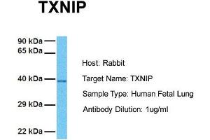 Host: Rabbit Target Name: TXNIP Sample Tissue: Human Fetal Lung Antibody Dilution: 1. (TXNIP anticorps  (C-Term))
