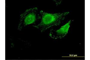 Immunofluorescence of monoclonal antibody to SLC12A2 on HeLa cell.