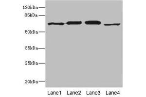 Western blot All lanes: RPN2 antibody at 1. (Ribophorin II anticorps  (AA 360-540))