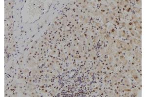 ABIN6278982 at 1/100 staining Human liver tissue by IHC-P. (MYCNOS anticorps)