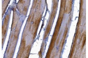 IHC analysis of PAK2 using anti-PAK2 antibody (ABIN7599219). (PAK2 anticorps  (AA 1-288))