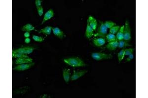 Immunofluorescence staining of Hela cells with ABIN7174472 at 1:66, counter-stained with DAPI. (UBE2N anticorps  (AA 20-138))