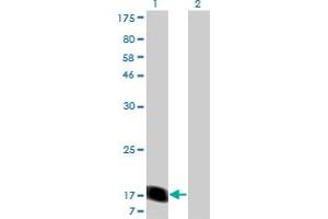 Western Blot analysis of RHEB expression in transfected 293T cell line by RHEB monoclonal antibody (M05), clone 1E12.
