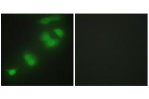 Immunofluorescence analysis of HepG2 cells, using CREBZF antibody. (CREBZF anticorps  (C-Term))