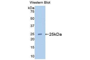 Western Blotting (WB) image for anti-Apolipoprotein M (APOM) (AA 20-190) antibody (ABIN1175641)