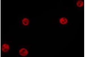 ABIN6275727 staining MCF7 by IF/ICC. (ZNF329 anticorps  (N-Term))