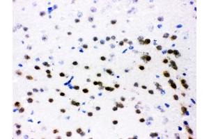 IHC testing of frozen mouse brain tissue with ATF2 antibody at 1ug/ml. (ATF2 anticorps  (AA 93-450))