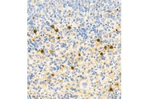 Immunohistochemistry analysis of paraffin embedded rat spleen using S100A9 (ABIN7075497) at dilution of 1: 1800