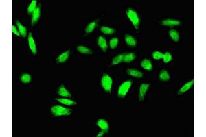 anti-TGFB-Induced Factor Homeobox 1 (TGIF1) (AA 8-375) antibody