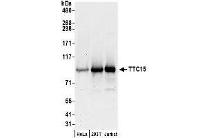 anti-Tetratricopeptide Repeat Domain 15 (TTC15) (AA 50-100) antibody