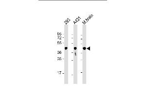 All lanes : Anti-PGK1 Antibody at 1:8000 dilution Lane 1: 293 whole cell lysate Lane 2: A431 whole cell lysate Lane 3: mouse brain lysate Lysates/proteins at 20 μg per lane. (PGK1 anticorps  (AA 1-417))