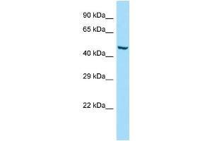 WB Suggested Anti-GMCL1 Antibody Titration: 1. (GMCL1 anticorps  (C-Term))