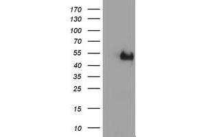 Image no. 2 for anti-LIM Homeobox 1 (LHX1) (AA 100-362) antibody (ABIN1490806) (LHX1 anticorps  (AA 100-362))